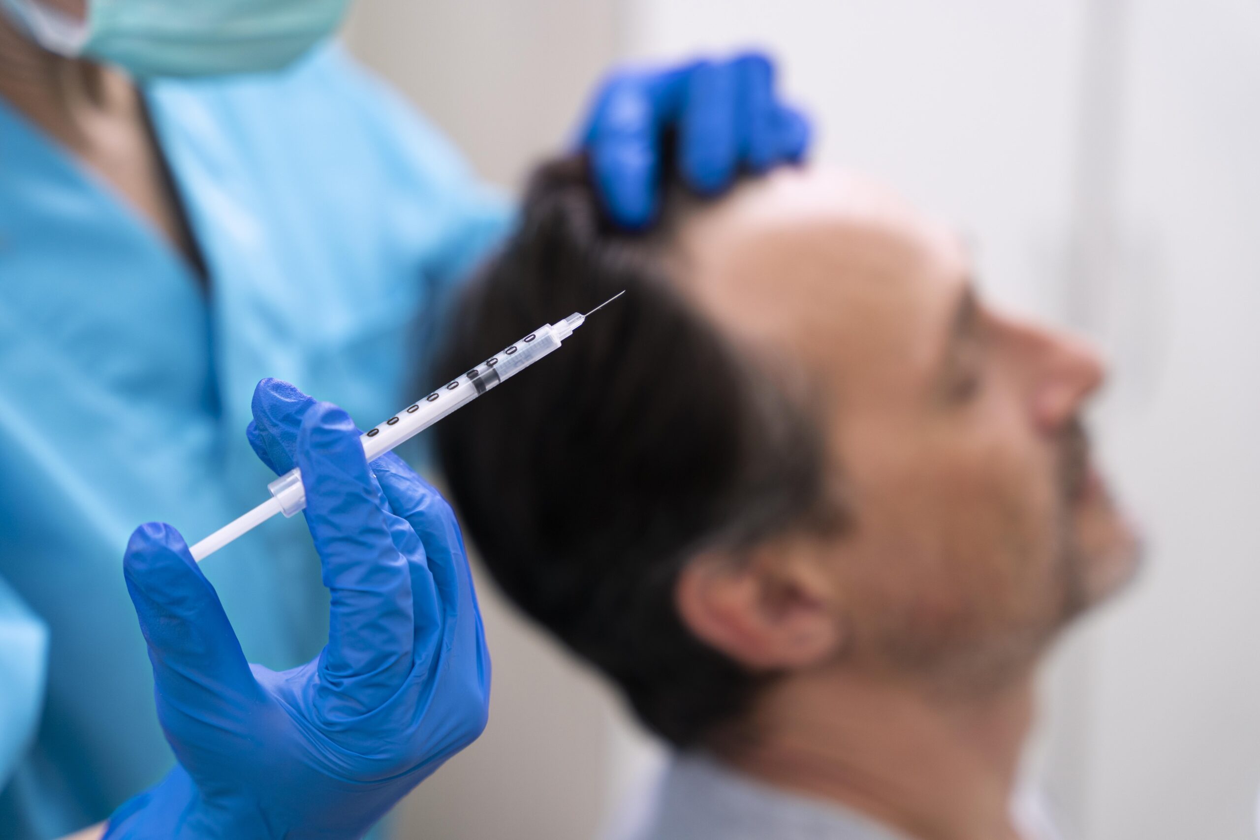 Understanding PRP Therapy for Pattern Baldness